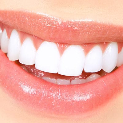 Want Whiter Brighter Teeth!  Smile Now.